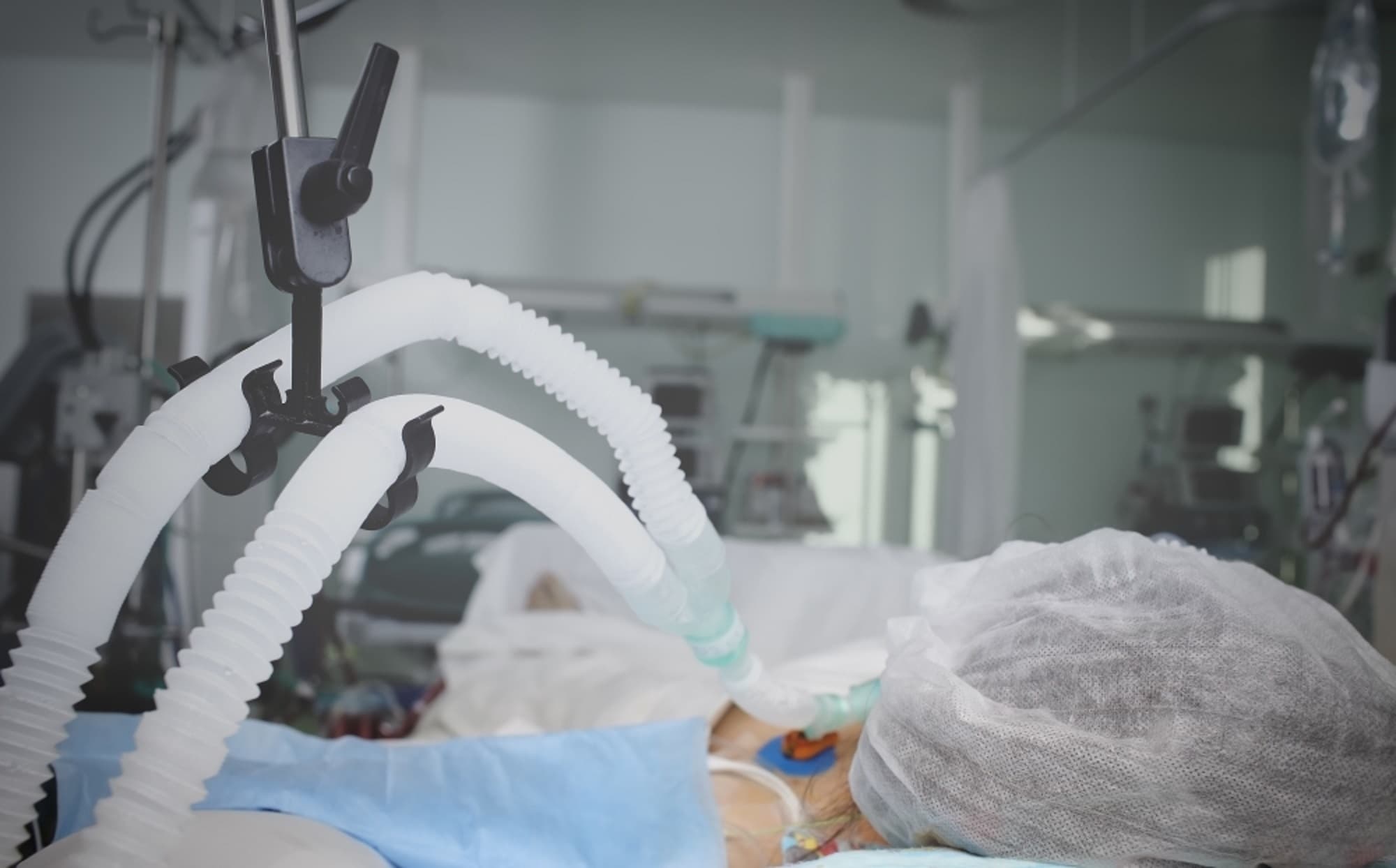 Ventilator Management